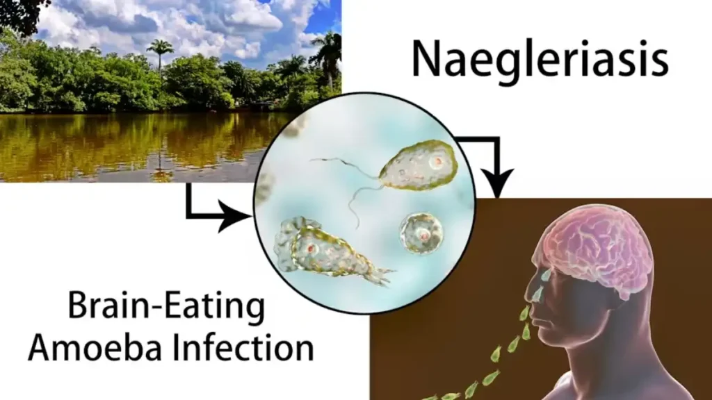 Naegleria fowleri