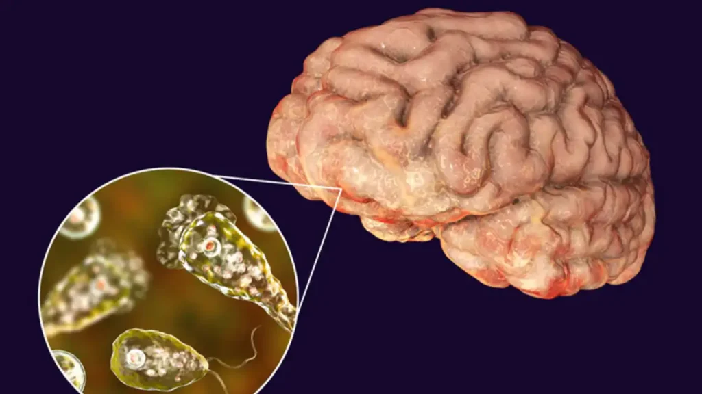 brain eating amoeba