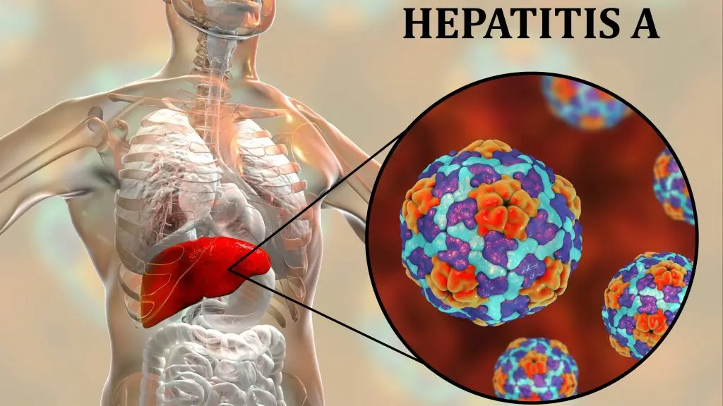 Hepatitis B 