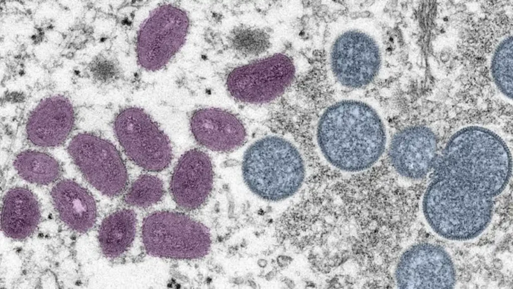 mpox virus